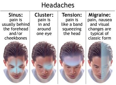 type of headache type of headache